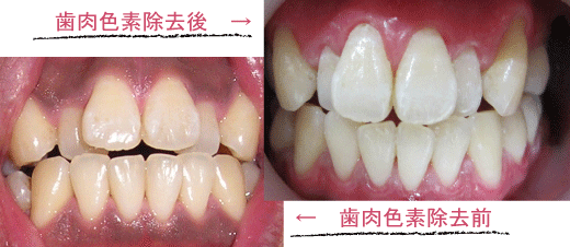 おおくぼ歯科医院メニュー